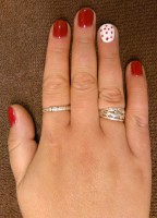 /album/boszipedikur/pottyos-gellakk-szolnok-jpg/